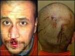George-Zimmerman-injuries-as-not-reported-by-the-media-540x405.jpg
