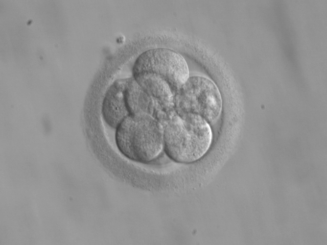 Embryo,_8_cells.jpg